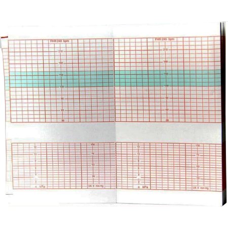 Fetal Diagnostic Monitor Recording Paper Edan® Thermal Paper 90 mm X 152 mm Roll Red Grid